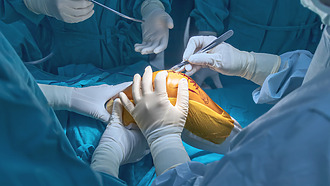 Total knee replacement surgery